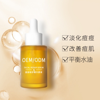 庆阳市_祛痘精华原液OEM